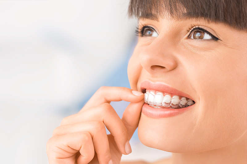 Sterling Heights invisalign